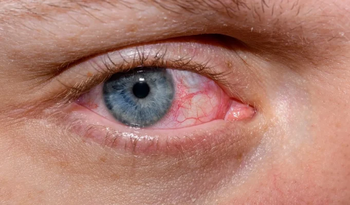 &Omicron; &alpha;&mu;&phi;&iota;&beta;&lambda;&eta;&sigma;&tau;&rho;&omicron;&epsilon;&iota;&delta;ή&sigmaf; &alpha;&pi;&omicron;&kappa;&alpha;&lambda;ύ&pi;&tau;&epsilon;&iota; &pi;&iota;&theta;&alpha;&nu;ή &sigma;ύ&nu;&delta;&epsilon;&sigma;&eta; &beta;&alpha;&kappa;&tau;&eta;&rho;ί&omicron;&upsilon; &mu;&epsilon; &tau;&omicron; &Alpha;&lambda;&tau;&sigma;&chi;ά&iota;&mu;&epsilon;&rho;